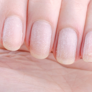 nail-3.png